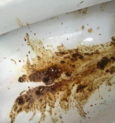 白色浆糊状大便的成因与调理方法