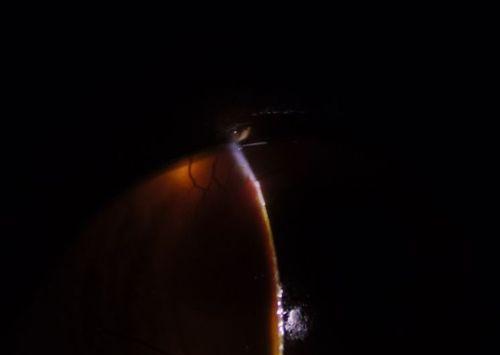 猫眼中的黑色物质是什么揭秘猫咪眼睛神秘构造