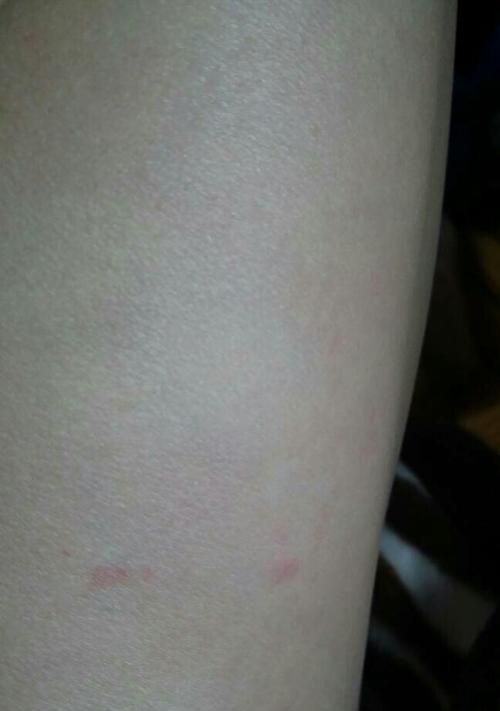 狗狗咬腿行为的15大原因及有效解决方案