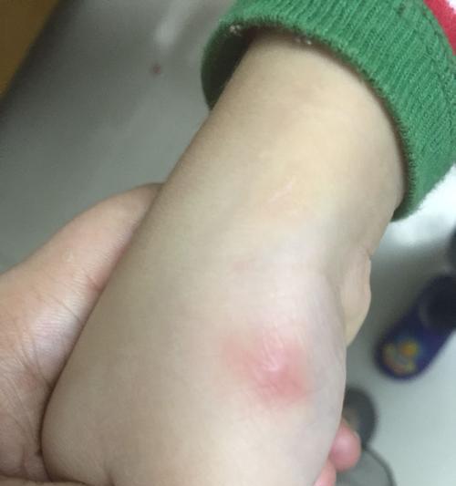 猫咪弓虫病症状识别与预防措施全攻略