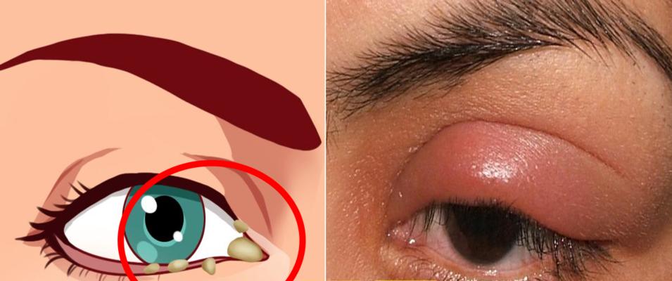 金毛犬眼屎多的原因分析及有效处理方法